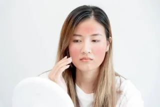 フォトナVのイメージ（頬の赤みが気になる女性）